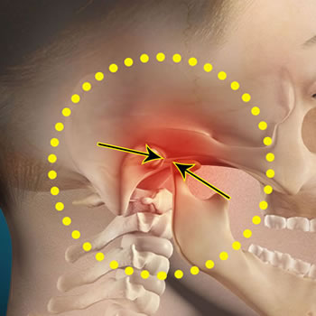 κροταφογναθική διάρθρωση,διάγνωση δυσλειτουργίας κροταφογναθικής διάρθρωσης,διάγνωση συνδρόμου κροταφογναθικής διάρθρωσης,θεραπεία δυσλειτουργίας κροταφογναθικής διάρθρωσης,θεραπεία συνδρόμου κροταφογναθικής διάρθρωσης